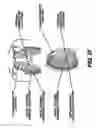 Fig. 33 - Obstructive Sleep Apnea Treatment Devices, Systems and Methods