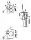 Fig. 47 - Obstructive Sleep Apnea Treatment Devices, Systems and Methods