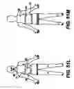 Fig. 49 - Obstructive Sleep Apnea Treatment Devices, Systems and Methods