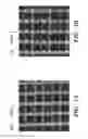 Fig. 02 - PROSTHETIC DEVICE AND METHOD OF USING IN BREAST AUGMENTATION AND/OR BREAST RECONSTRUCTION