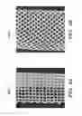Fig. 06 - PROSTHETIC DEVICE AND METHOD OF USING IN BREAST AUGMENTATION AND/OR BREAST RECONSTRUCTION