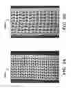 Fig. 07 - PROSTHETIC DEVICE AND METHOD OF USING IN BREAST AUGMENTATION AND/OR BREAST RECONSTRUCTION