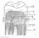 Fig. 01 - Zirconium dioxide based prostheses