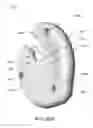 Fig. 49 - Disc-shaped orthopedic devices
