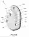 Fig. 63 - Disc-shaped orthopedic devices