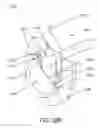 Fig. 64 - Disc-shaped orthopedic devices