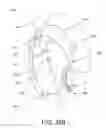 Fig. 71 - Disc-shaped orthopedic devices