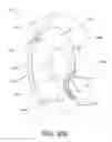 Fig. 85 - Disc-shaped orthopedic devices
