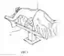 Fig. 02 - Direct lateral spine system instruments, implants and associated methods
