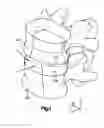 Fig. 02 - Spine disc replacement with compliant articulating core