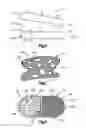 Fig. 07 - Spine disc replacement with compliant articulating core