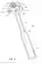 Fig. 07 - Cannulated Hemi-Implant and Methods of Use Thereof