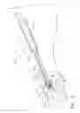 Fig. 10 - Cannulated Hemi-Implant and Methods of Use Thereof