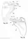 Fig. 02 - Method and apparatus for preparing for a surgical procedure