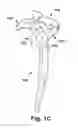 Fig. 03 - Method and apparatus for preparing for a surgical procedure