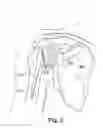 Fig. 04 - Method and apparatus for preparing for a surgical procedure