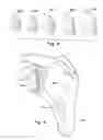 Fig. 06 - Method and apparatus for preparing for a surgical procedure