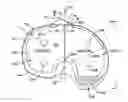 Fig. 01 - Asymmetric tibial components for a knee prosthesis