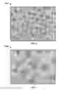 Fig. 04 - Implant components and methods
