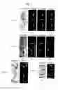 Fig. 02 - METHODS FOR PREVENTING OR INHIBITING MICROBIAL INFECTION OF PLANTS AND PLANT EXHIBITING RESISTANCE TO MICROBIAL INFECTION