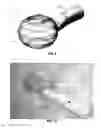 Fig. 07 - Vacuum attachment assembly