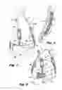 Fig. 02 - PANNUS SUPPORT ADAPTED FOR SURGICAL PROCEDURES