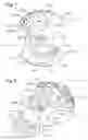 Fig. 05 - Methods of using a particle impact drilling system for removing near-borehole damage, milling objects in a wellbore, under reaming, coring, perforating, assisting annular flow, and associated methods
