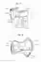 Fig. 07 - Methods of using a particle impact drilling system for removing near-borehole damage, milling objects in a wellbore, under reaming, coring, perforating, assisting annular flow, and associated methods