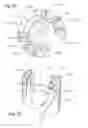 Fig. 12 - Methods of using a particle impact drilling system for removing near-borehole damage, milling objects in a wellbore, under reaming, coring, perforating, assisting annular flow, and associated methods