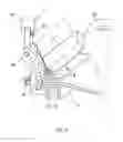 Fig. 18 - Carrier system having a front and back part and means for fastening to a human torso