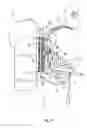 Fig. 19 - Carrier system having a front and back part and means for fastening to a human torso