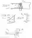 Fig. 06 - COMPRESSION BONE STAPLE, APPARATUS AND METHOD OF THE INVENTION
