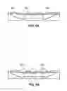 Fig. 07 - Routable array metal integrated circuit package fabricated using partial etching process