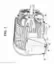 Fig. 02 - Electric motor apparatus