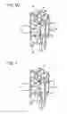 Fig. 08 - Drive transmission device including a detection device and a protection member made of a conductive material