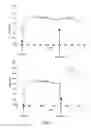 Fig. 02 - HK1-BINDING PROTEINS