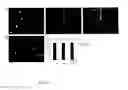 Fig. 11 - Cell and therapeutical and diagnostical methods based thereon