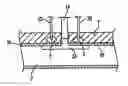Fig. 01 - Apparatus for sealing a puncture by causing a reduction in the circumference of the puncture