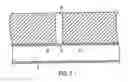 Fig. 02 - Apparatus for sealing a puncture by causing a reduction in the circumference of the puncture