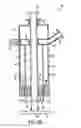 Fig. 04 - Apparatus for sealing a puncture by causing a reduction in the circumference of the puncture