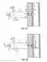 Fig. 06 - Apparatus for sealing a puncture by causing a reduction in the circumference of the puncture