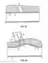 Fig. 08 - Apparatus for sealing a puncture by causing a reduction in the circumference of the puncture