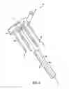 Fig. 10 - Apparatus for sealing a puncture by causing a reduction in the circumference of the puncture