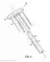 Fig. 11 - Apparatus for sealing a puncture by causing a reduction in the circumference of the puncture