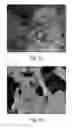 Fig. 09 - ELECTROCATALYST OF CARBON NANOTUBES ENCAPSULATING PLATINUM GROUP METAL NANOPARTICLES FOR FUEL CELLS