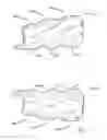 Fig. 08 - Dental orthotic
