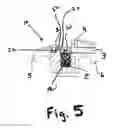 Fig. 06 - Self ligating bracket system