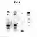 Fig. 03 - AMPLIFICATION GENIQUE STATISTIQUE POUR L'IDENTIFICATION SANS A PRIORI DE MICRO-ORGANISMES PAR SEQUENCAGE SANS ETAPE DE CLONAGE