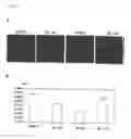 Fig. 07 - GENES AND POLYPEPTIDES RELATING TO HUMAN PANCREATIC CANCERS