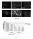 Fig. 256 - Microcarriers for Stem Cell Culture